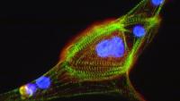 Image of a Header Staining Composite